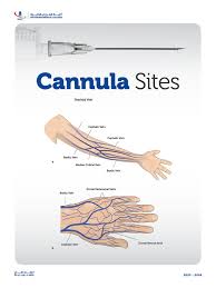 Image result for IV Access