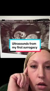 Baby 64 Ultrasound Brooklyn Joy Mayberry