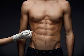 Trichterbrust / kielbrust mit fehlen oder unterentwicklung eines brustmuskels. Blog News And Resources On Male Plastic Surgery Archives Male Plastic Surgerymale Plastic Surgery