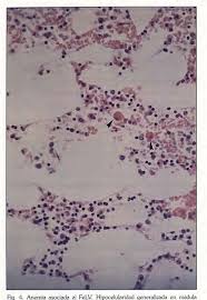 In the final stages of felv, your cat's health will be severely compromised by the infection. Pdf Enfermedades Por Inmunosupresion Asociadas Al Virus De La Leucemia Felina Semantic Scholar