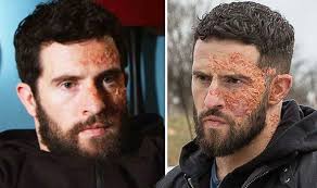 Emmerdale cast: Michael Parr reveals real life connection to Ross Barton  acid attack plot