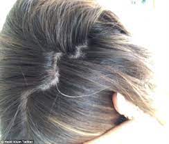 Vitamin b12 deficiency can also cause gray hair. Heidi Klum Reveals First Grey Hair In New Instagram Snap Daily Mail Online