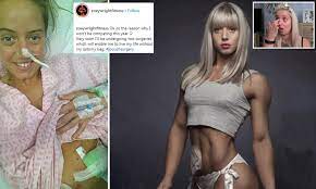 Model joy corrigan was also seen strutting her stuff carrying bottega veneta's popular cassette bag. Bodybuilder Zoe Wright Reveals She S Having Ostomy Bag Removed Daily Mail Online