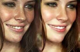 Atención dermatológica en Oaxaca