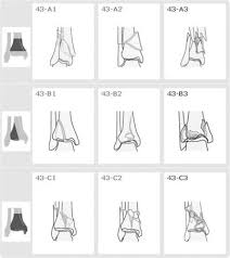 Unstable fractures require surgery, whereas stable fractures can be treated conservatively with a short leg cast. Tibial Plafond Fractures Trauma Orthobullets
