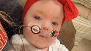 Fundraiser for Jeff Speegle by Lina Criddle : Baby Alyssa's fight against  Trisomy 18