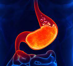 20 Causes Of Burning Sensation In Stomach Natural Home Remedies