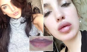 Make-up artist Eve Morrison who had a lip tattoo claims she's been scarred  for life