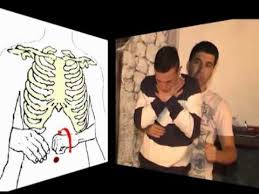 Heimlich manevrası uygulamak sağlıklı bir yöntemdir. Heimlich Manevrasi Nasil Uygulanir Youtube