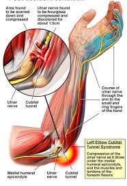 Pin On Shoulder Arm Neck Pain