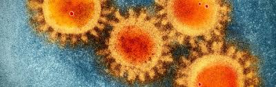 Tun sie dies auch, wenn sie nur. Sars Cov 2 Proteine Entschlusseln Um Das Coronavirus Ausschalten Spektrum Der Wissenschaft