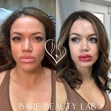 Michelle Camarillo (@barebeautylabtx) • Instagram photos and videos