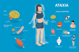 Image result for Ataxia