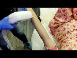 Avx400 salon quality permanent electrolysis system for underarms. Laser Hair Removal In Mumbai With Cost Best Permanent Hair Removal Skingenious