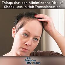 You may also face redness in the recipient area. Things That Can Minimize The Risk Of Shock Loss From Hair Transplantation Aesthetic Dermatology Hair Transplantation Hair Transplant