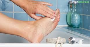 Hornhaut Entfernen Mit Hausmitteln In 3 Schritten Zu Babyweichen Fussen Hornhaut Entfernen Hornhaut Hausmittel