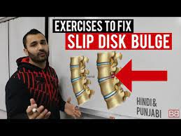We did not find results for: Fix Slip Disc Bulge Back Pain At Home Hindi Punjabi Youtube