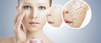 Bị nứt gót chân là thiếu chất gì và cần bổ sung gì?