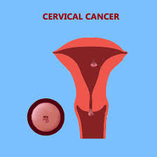 Common cancer symptoms and signs in tamil knowing the early signs / symptoms of cancer can help you or a loved one. Best Cancer Hospital In India Cervical Cancer Treatment In Coimbatore Tamil Nadu