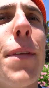 Customizing A Drum Set For A Millionaire