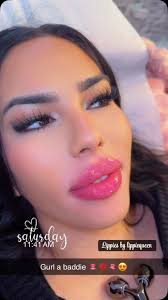 Dolly Lippies ❤️💋👄✅ my fav!, Got lips? 👄 Come get some! Turn heads be a  baddie 💋, #lippiequeen #filler #denverinjector #lipfiller #lip #botox  #colorado #beauty #dermalfiller #fillamachine #baddies ...