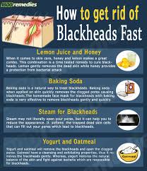 Pin On Home Remedies