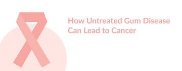 Either way, it sounds like this could potentially cause cancer. How Untreated Periodontal Disease Can Lead To Cancer