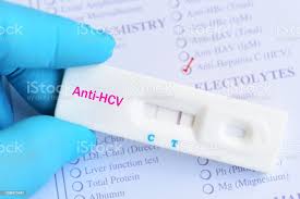 Foto De Resultado De Teste Positivo De Virus Da Hepatite C E Mais Fotos De Stock De Analisar Istock