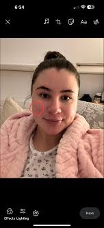 Hello!! I'm a nurse and struggle with rosacea (quite bad). My face is  constantly red and people make it worse when making comments like “are you  sunburnt or have you got a