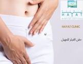 مركز مستشفى الحياة الطبي اسطنبول