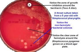 Image result for Group D Streptococcus