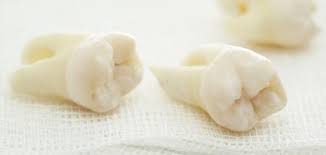 مفيش بطالة والشباب بيشتغل ويكسب. ØªÙØ³ÙŠØ± Ø­Ù„Ù… Ø®Ù„Ø¹ Ø§Ù„Ø¶Ø±Ø³ Ù…ÙˆØ¶ÙˆØ¹