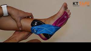 Reduced activity, stretching the calves, massage therapy, weight loss in overweight individuals, foam rolling, ice, and nsaids can all serve to help alleviate symptoms and treat plantar fasciitis. Tape It Tuesday Plantar Fasciitis Youtube