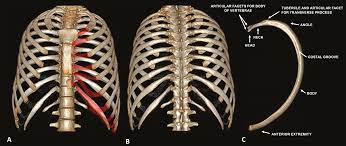 Each pig has 14 rib bones which are attached to the spine and divided into the four most popular cuts. Scielo Brasil Anatomical Variations And Congenital Anomalies Of The Ribs Revisited By Multidetector Computed Tomography Anatomical Variations And Congenital Anomalies Of The Ribs Revisited By Multidetector Computed Tomography