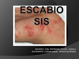 Este ácaro que produce la sarna en humanos es el causante de unas erupciones cutáneas que se distinguen por la zona en la que se producen, entre los dedos de los pies o manos, el cuero cabelludo. Escabiosis