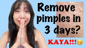 Exfoliating a couple days after your wax will help prevent ingrown hairs and infection. After Brazilian Wax How To Remove White Bumps Pimples Fast Philippines Saki Youtube