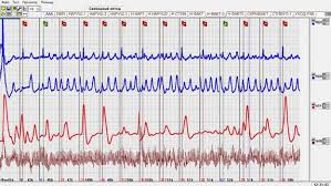 Amanda says her father sexually abused her for more than a decade, but some family members refuse to believe her; What Does Inconclusive Mean On A Polygraph Test Missing Persons Of America