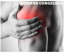 Que Es El Hombro Congelado El Hombro Congelado O Capsulitis Adhesiva Es Una Patologia Del Hombro Qu Centro De Fisioterapia Fisioterapia Capsulitis Adhesiva