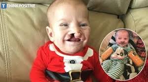 Mom Uplifted By Act Of Kindness After Hurtful Comment About Son's Cleft  Palate