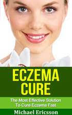 Eczema: The Ultimate Eczema Treatment Guide eBook by Dr. Michael Ericsson