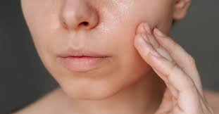 Image result for Dry Skin