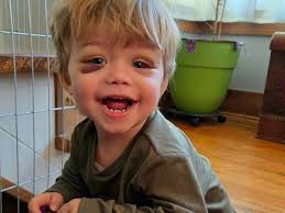 Fundraiser for Jacqueline Block by Stacy Wilkins : Beckett Tough, let's  help his fight against cancer