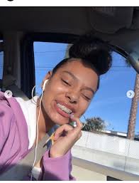 Los brackets de colores seran abrazados en los próximos dos años. Pin By Massiel Calderon On Brace Face Light Skin Girls Cute Braces Braces Girls