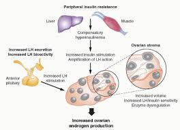 Image result for Anovulation