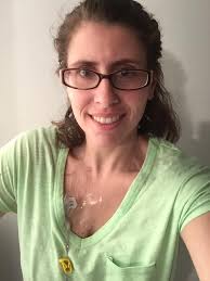 Sam Bixby's transplant journey and recovery experience