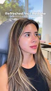 Full Facial Balancing isn't about changing who you are it's about enhancing  what already makes you you ✨ By strategically restoring volume, improving  symmetry, and softening key areas, we create a balanced,