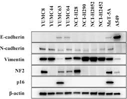 Cell lines are useful models for studying the biological characteristics of tumors; Establishment And Molecular Characterization Of Cell Lines From Japanese Patients With Malignant Pleural Mesothelioma
