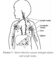 Ebv belongs in the herpes virus family and is widespread. Mononucleosis Infectious Symptoms Diagnosis And Treatment