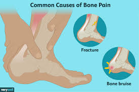Bone Pain Causes Treatment And When To See A Doctor
