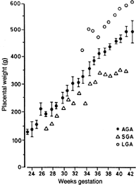 Intrauterine Growth Restriction And The Small For